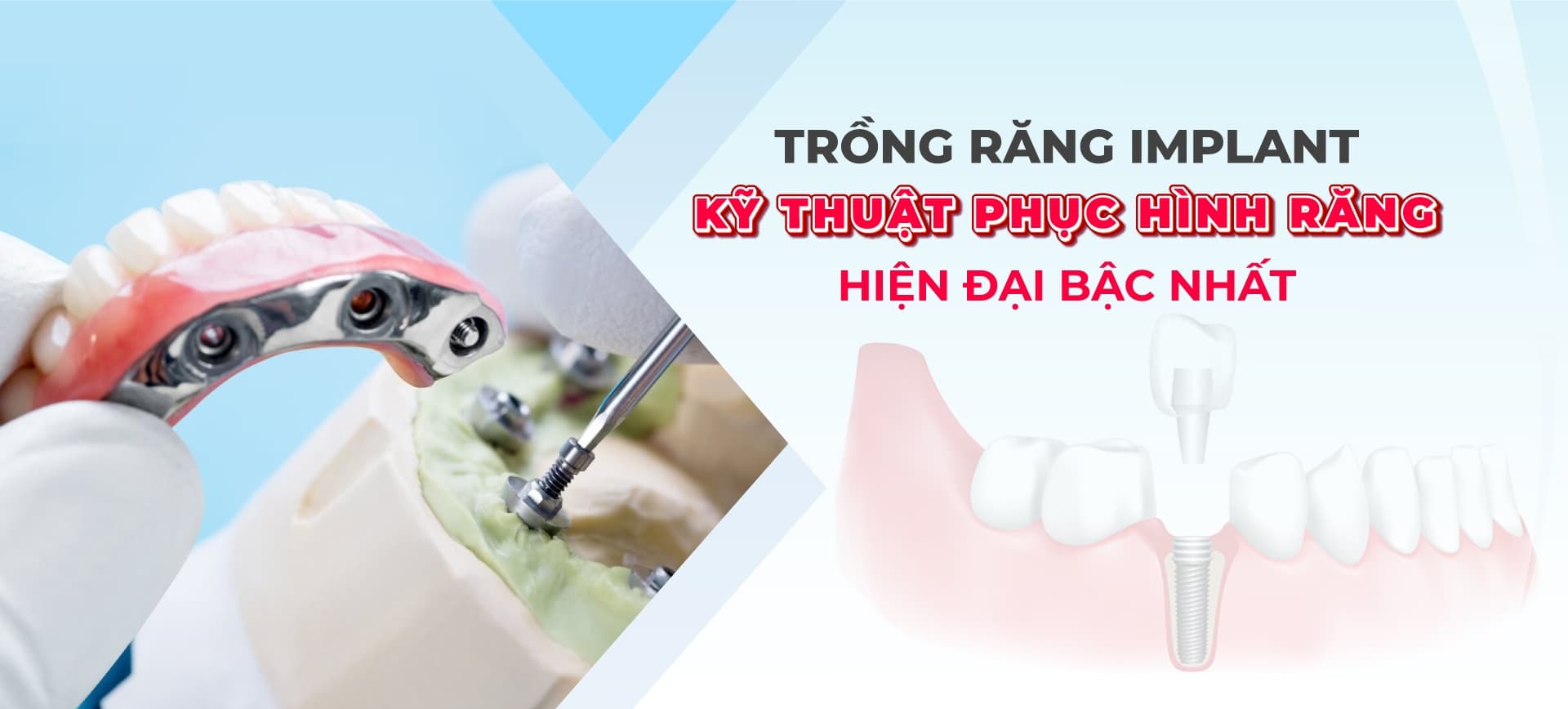 Thiết kế CAD/CAM