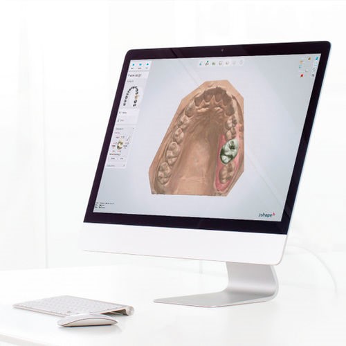 CAD/CAM TECHNOLOGY SYSTEM APPLIED IN THE DENTAL FIELD - IKALAB ...